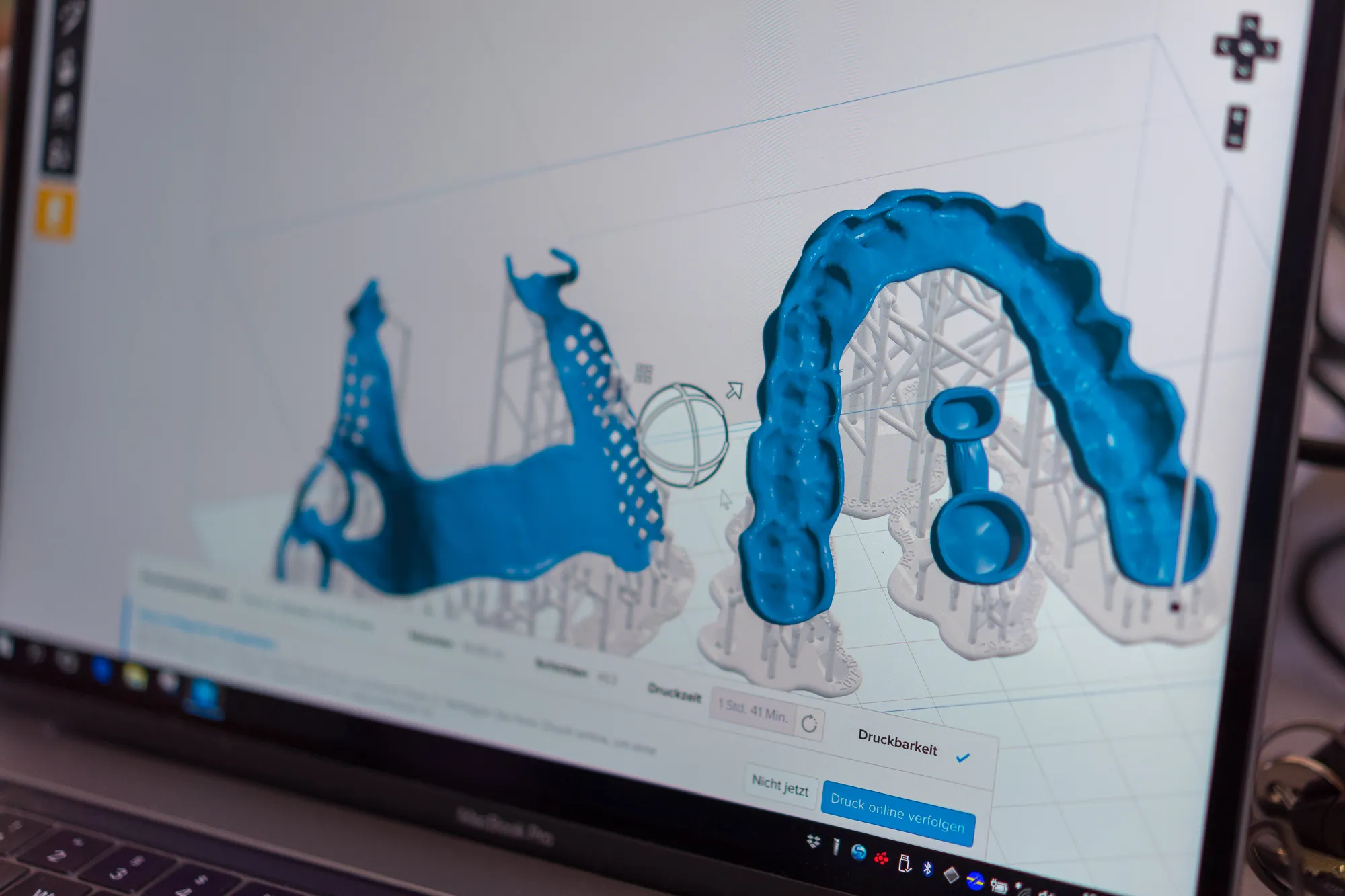 Bildschirm mit CAD-Software für Dentaltechnik in der Fertigung